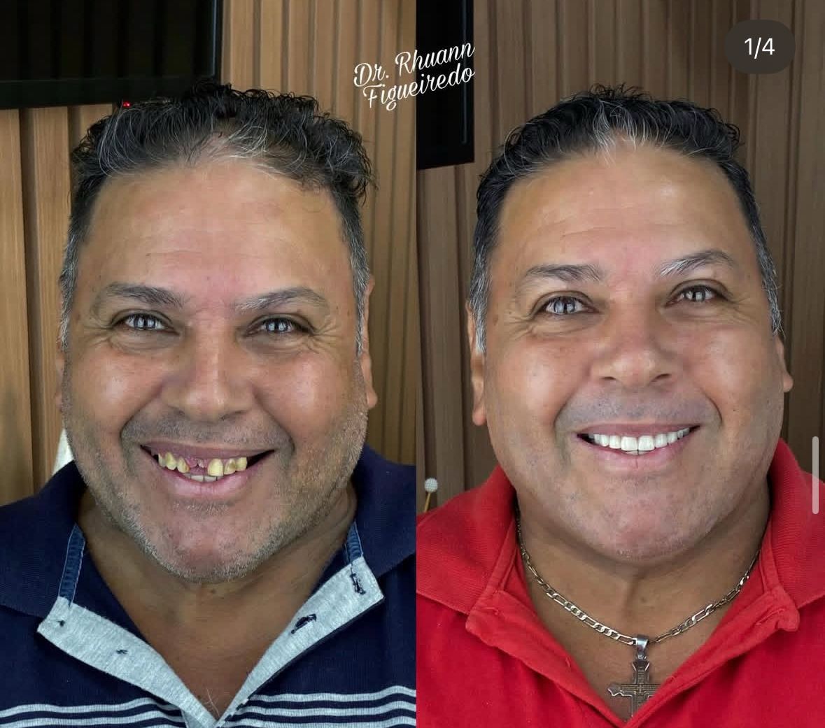 Caso de tratamento Almani