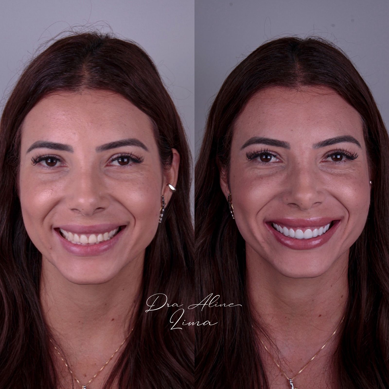 Caso de tratamento Almani